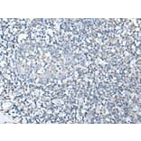 SPTA1 Antibody from Signalway Antibody (43755) - Antibodies.com