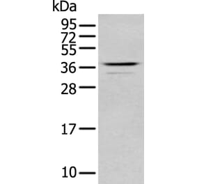 ABHD6 Antibody from Signalway Antibody (43758) - Antibodies.com