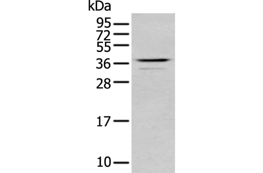ABHD6 Antibody from Signalway Antibody (43758) - Antibodies.com