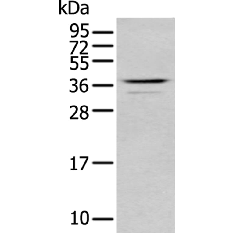 ABHD6 Antibody from Signalway Antibody (43758) - Antibodies.com