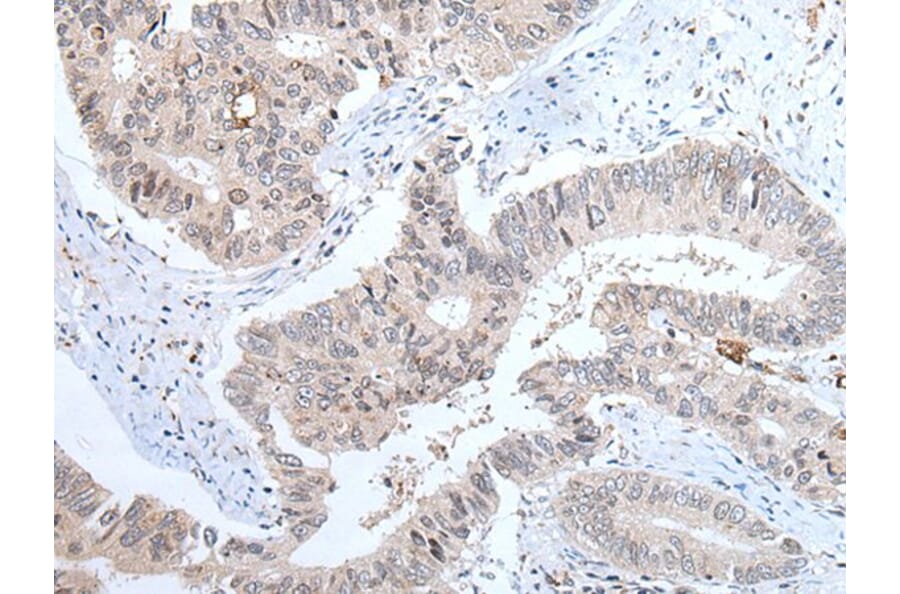 ABHD6 Antibody from Signalway Antibody (43758) - Antibodies.com