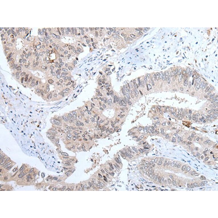 ABHD6 Antibody from Signalway Antibody (43758) - Antibodies.com