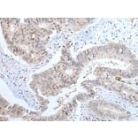 ABHD6 Antibody from Signalway Antibody (43758) - Antibodies.com