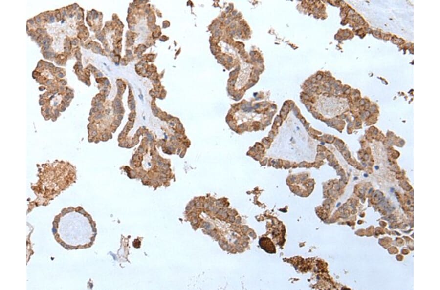 ABHD6 Antibody from Signalway Antibody (43758) - Antibodies.com