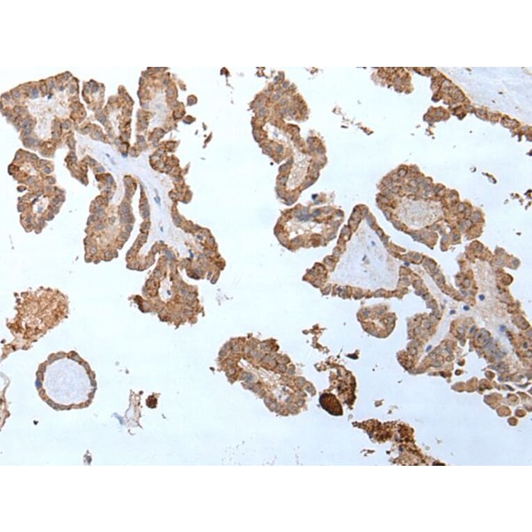 ABHD6 Antibody from Signalway Antibody (43758) - Antibodies.com