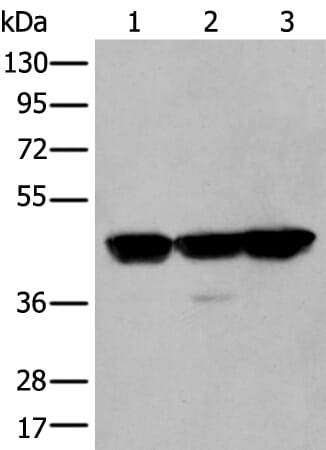 Gel: 8% SDS-PAGE Lysate: 40 &#956;g, Lane 1-3: Hela£¬A431 and Hepg2 cell lysates, Primary antibody: PLAG1 antibody at dilution 1/200 dilution, Secondary antibody: Goat anti rabbit IgG at 1/8000 dilution, Exposure time: 2 seconds