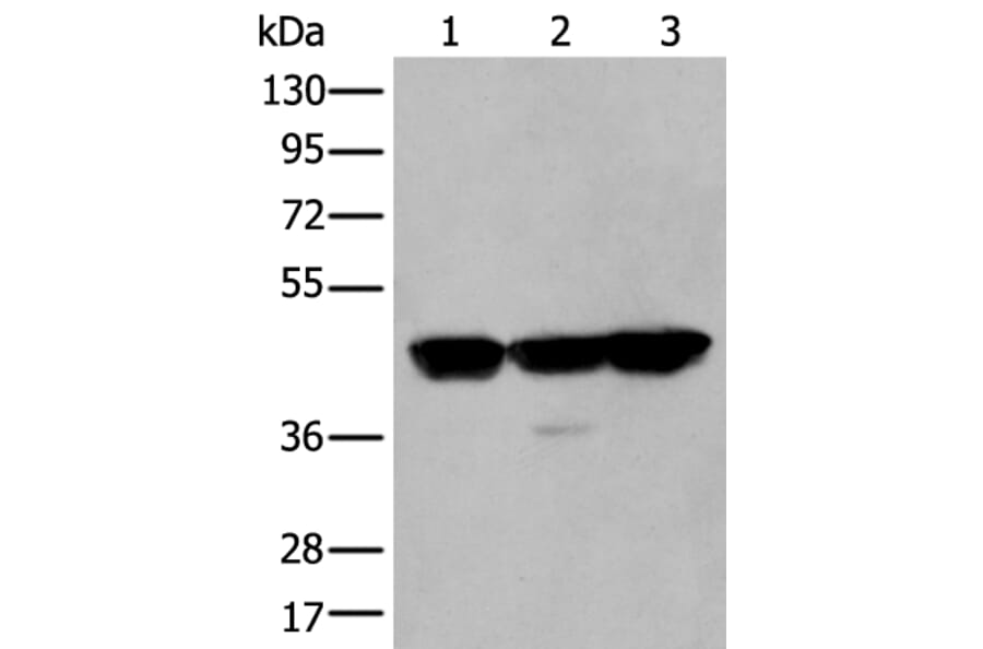PLAG1 Antibody from Signalway Antibody (43767) - Antibodies.com