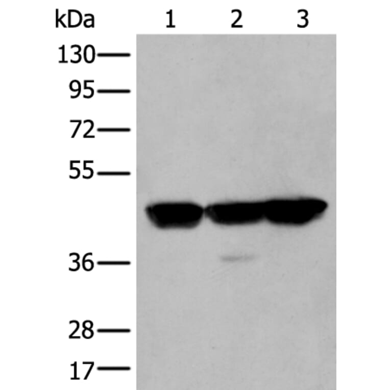 PLAG1 Antibody from Signalway Antibody (43767) - Antibodies.com