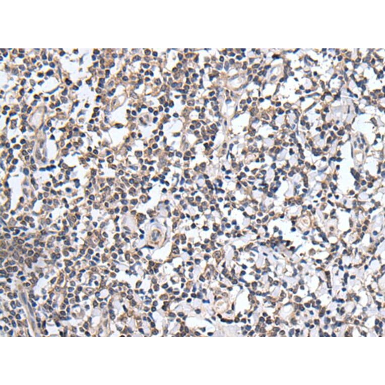 PLAG1 Antibody from Signalway Antibody (43767) - Antibodies.com