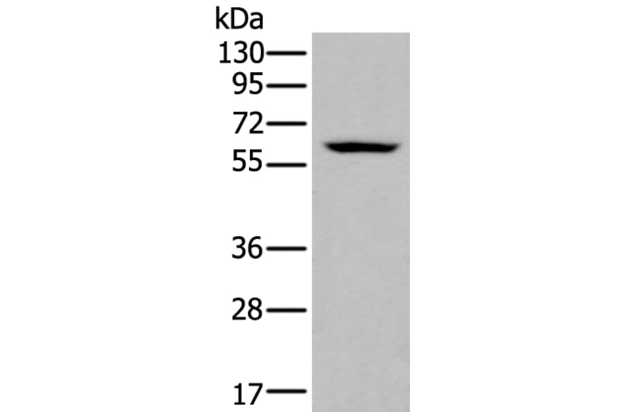 ZNF76 Antibody from Signalway Antibody (43789) - Antibodies.com