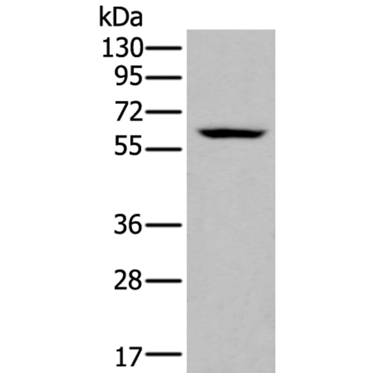 ZNF76 Antibody from Signalway Antibody (43789) - Antibodies.com