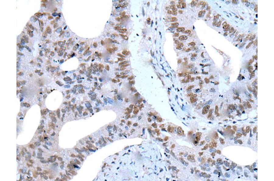 ZNF76 Antibody from Signalway Antibody (43789) - Antibodies.com