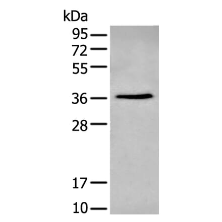 NHEJ1 Antibody from Signalway Antibody (43802) - Antibodies.com