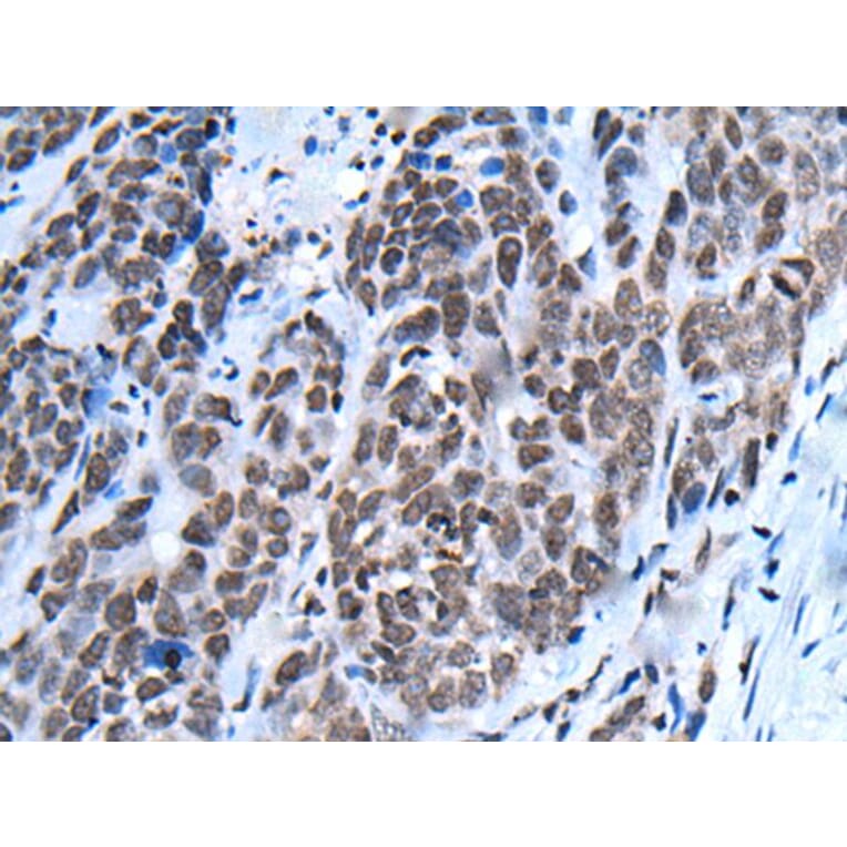 NHEJ1 Antibody from Signalway Antibody (43802) - Antibodies.com