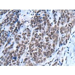 NHEJ1 Antibody from Signalway Antibody (43802) - Antibodies.com