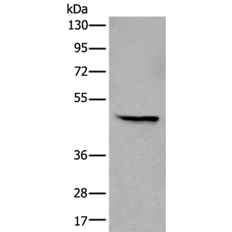 WIPF2 Antibody from Signalway Antibody (43812) - Antibodies.com