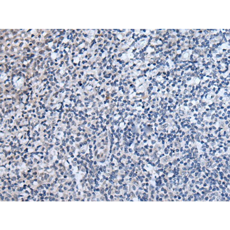 WIPF2 Antibody from Signalway Antibody (43812) - Antibodies.com