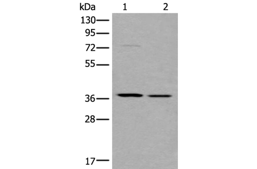 WNT9B Antibody from Signalway Antibody (43817) - Antibodies.com
