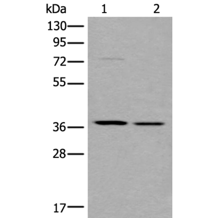 WNT9B Antibody from Signalway Antibody (43817) - Antibodies.com