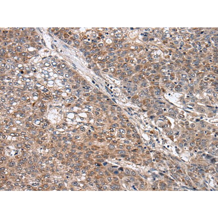 WNT9B Antibody from Signalway Antibody (43817) - Antibodies.com