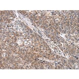 WNT9B Antibody from Signalway Antibody (43817) - Antibodies.com