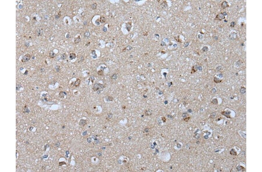 VPS35 Antibody from Signalway Antibody (43824) - Antibodies.com