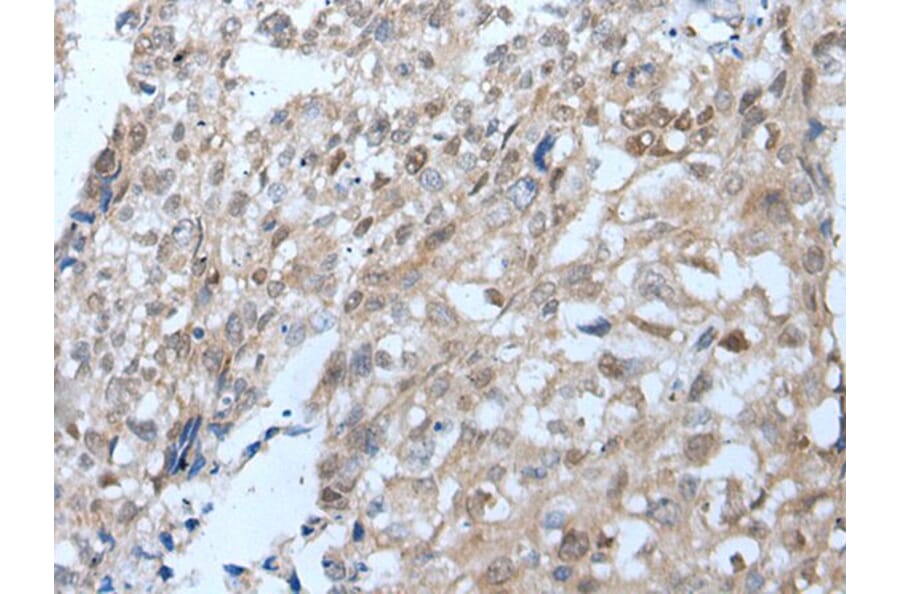 VPS35 Antibody from Signalway Antibody (43824) - Antibodies.com