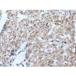 VPS35 Antibody from Signalway Antibody (43824) - Antibodies.com