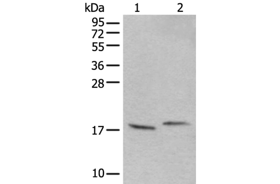 UBA52 Antibody from Signalway Antibody (43827) - Antibodies.com
