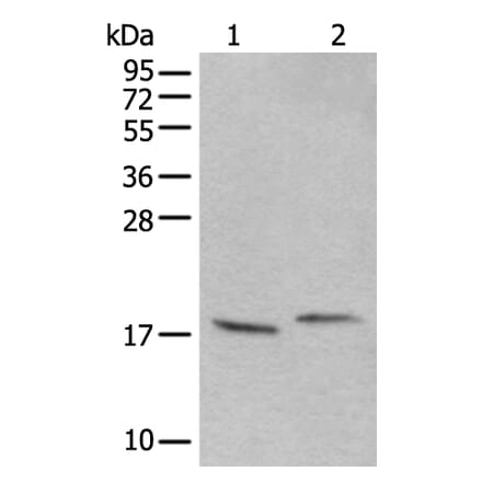 UBA52 Antibody from Signalway Antibody (43827) - Antibodies.com