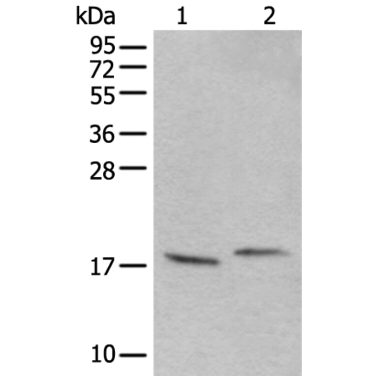 UBA52 Antibody from Signalway Antibody (43827) - Antibodies.com