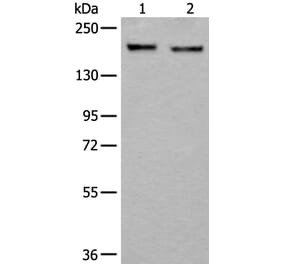 ERBB2 Antibody from Signalway Antibody (43832) - Antibodies.com