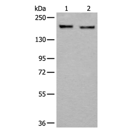 ERBB2 Antibody from Signalway Antibody (43832) - Antibodies.com