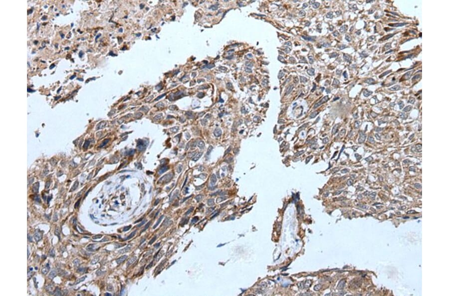 ERBB2 Antibody from Signalway Antibody (43832) - Antibodies.com