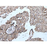 ERBB2 Antibody from Signalway Antibody (43832) - Antibodies.com