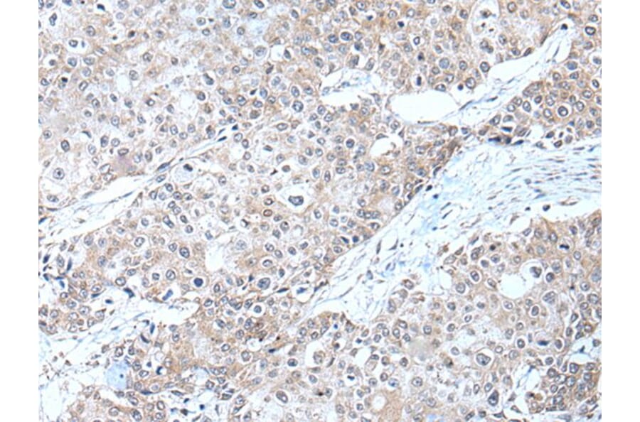 ERBB2 Antibody from Signalway Antibody (43832) - Antibodies.com