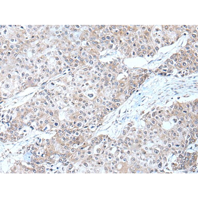 ERBB2 Antibody from Signalway Antibody (43832) - Antibodies.com