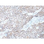 ERBB2 Antibody from Signalway Antibody (43832) - Antibodies.com