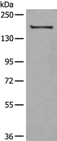 Gel: 6%SDS-PAGE Lysate: 40 &#956;g, Lane: A172 cell lysate, Primary antibody: µgGT1 antibody at dilution 1/250, Secondary antibody: Goat anti rabbit IgG at 1/8000 dilution, Exposure time: 20 seconds