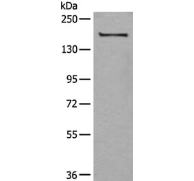 UGGT1 Antibody from Signalway Antibody (43834) - Antibodies.com
