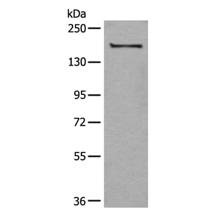 UGGT1 Antibody from Signalway Antibody (43834) - Antibodies.com