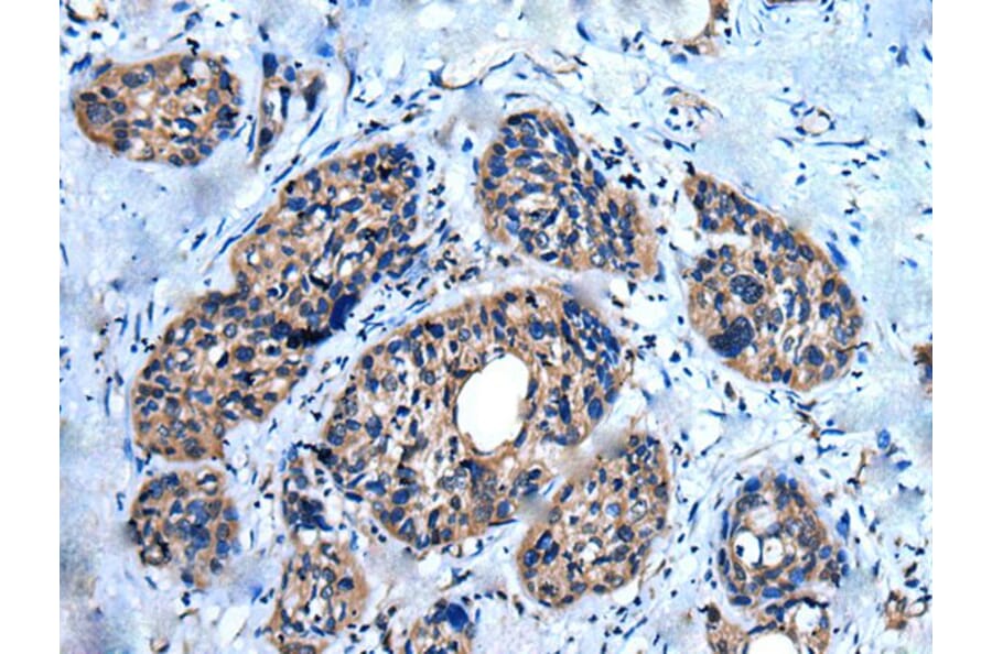 UNC5A Antibody from Signalway Antibody (43837) - Antibodies.com