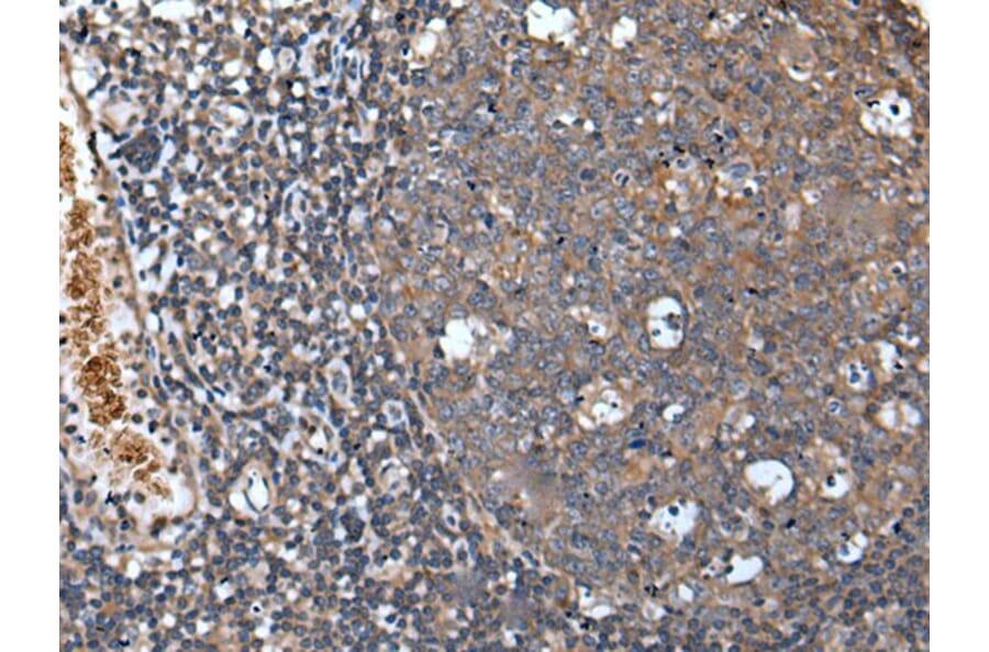 UNC5A Antibody from Signalway Antibody (43837) - Antibodies.com