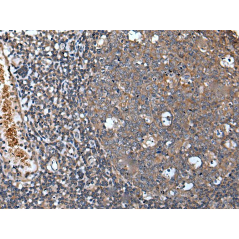 UNC5A Antibody from Signalway Antibody (43837) - Antibodies.com