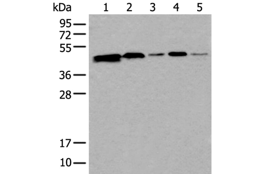 CD274 Antibody from Signalway Antibody (43858) - Antibodies.com