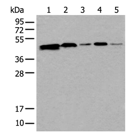 CD274 Antibody from Signalway Antibody (43858) - Antibodies.com
