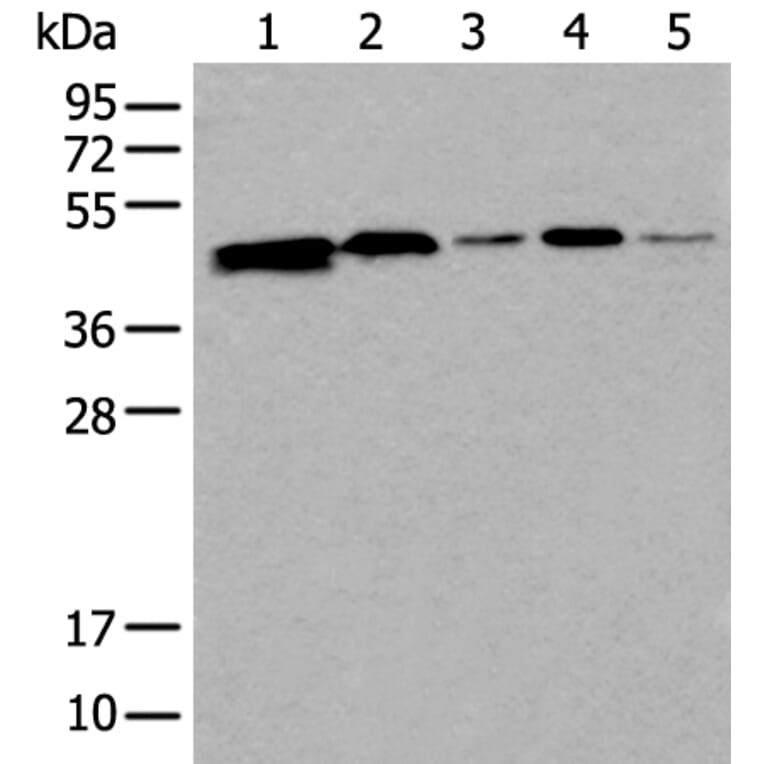 CD274 Antibody from Signalway Antibody (43858) - Antibodies.com