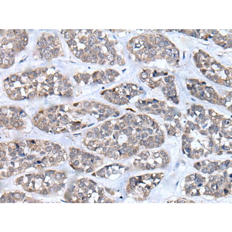 CD274 Antibody from Signalway Antibody (43858) - Antibodies.com