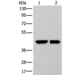 DLK1 Antibody from Signalway Antibody (43875) - Antibodies.com