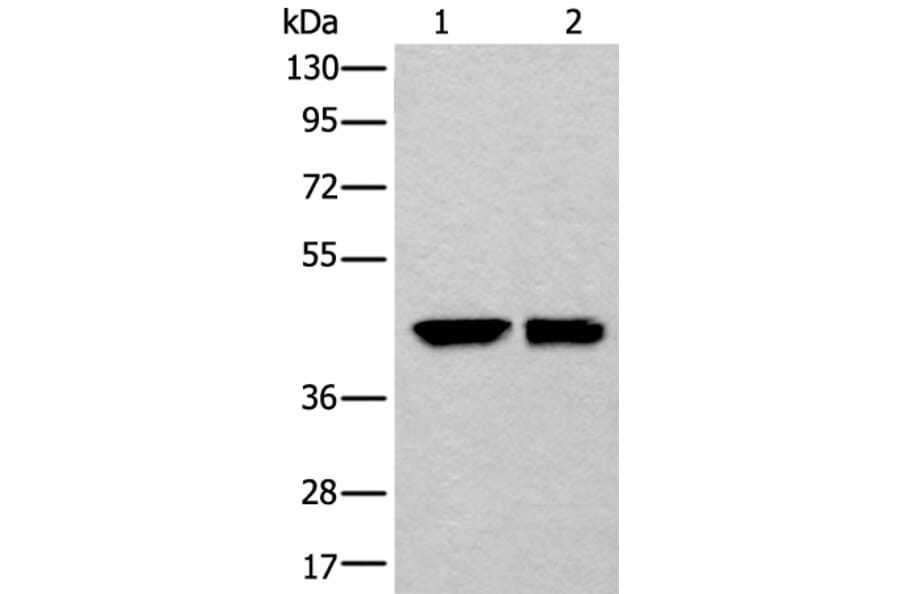 DLK1 Antibody from Signalway Antibody (43875) - Antibodies.com